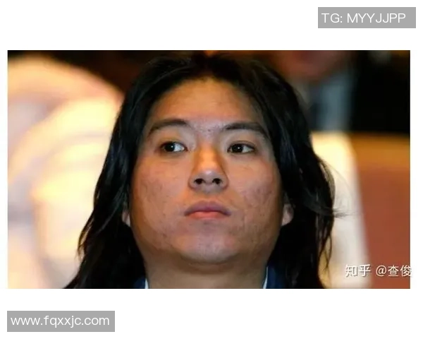 足球明星因吃瓜事件引发热议网友热评纷纷点赞与吐槽交织 足球明星因吃瓜事件引发热议网友热评纷纷点赞与吐槽交织